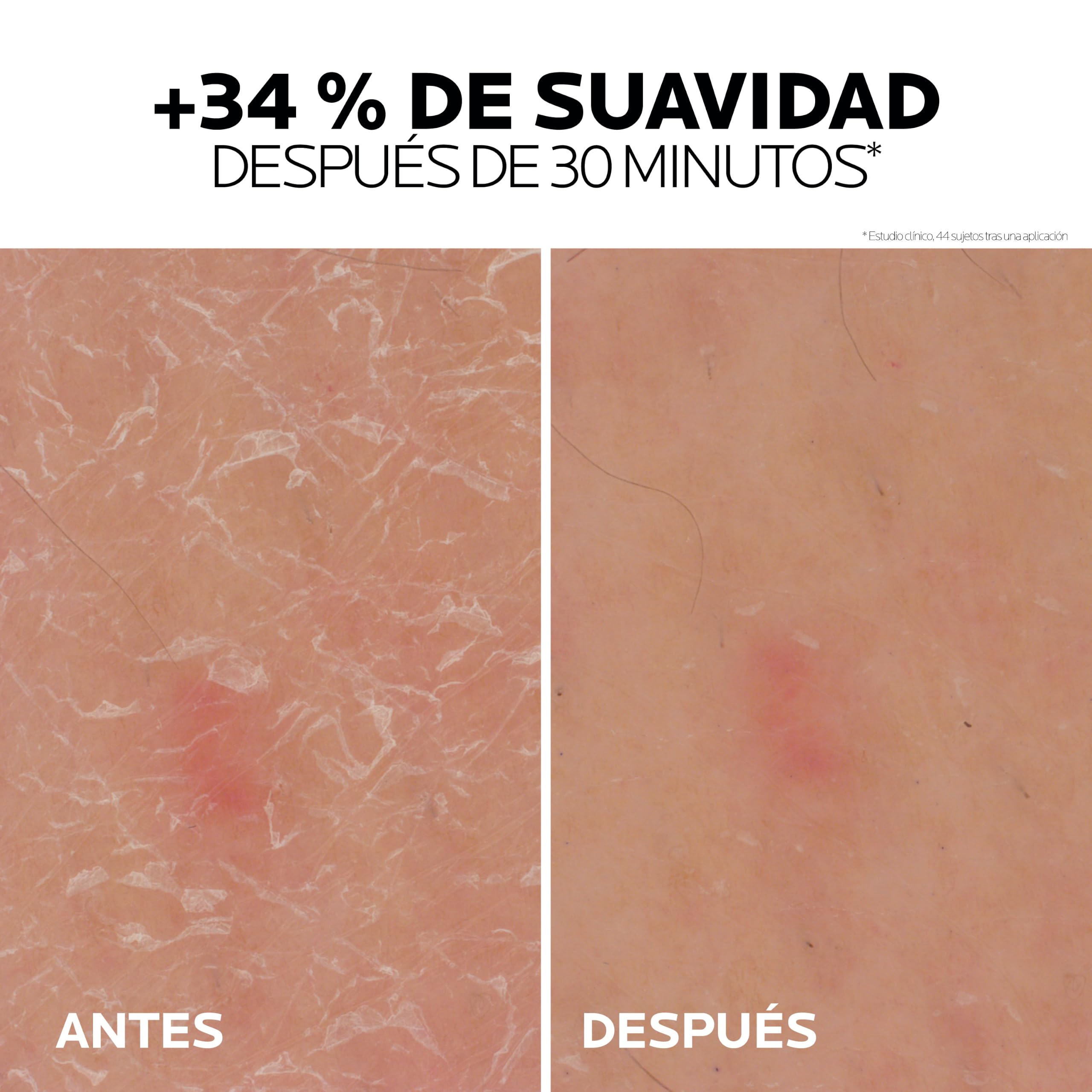 la-roche-posay-lipikar-gel-urea-30-gel-ultraconcentrado-para-piel-extremadamente image 4