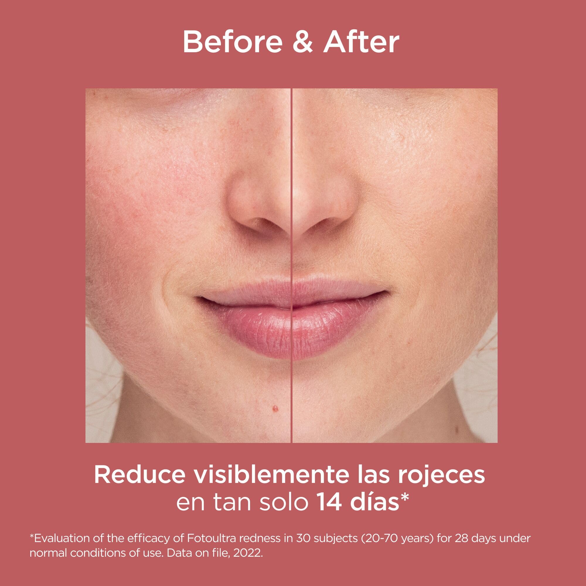 isdin-fotoultra-redness-spf-50-protector-solar-facial-con-color-para-piel-sensib image 8