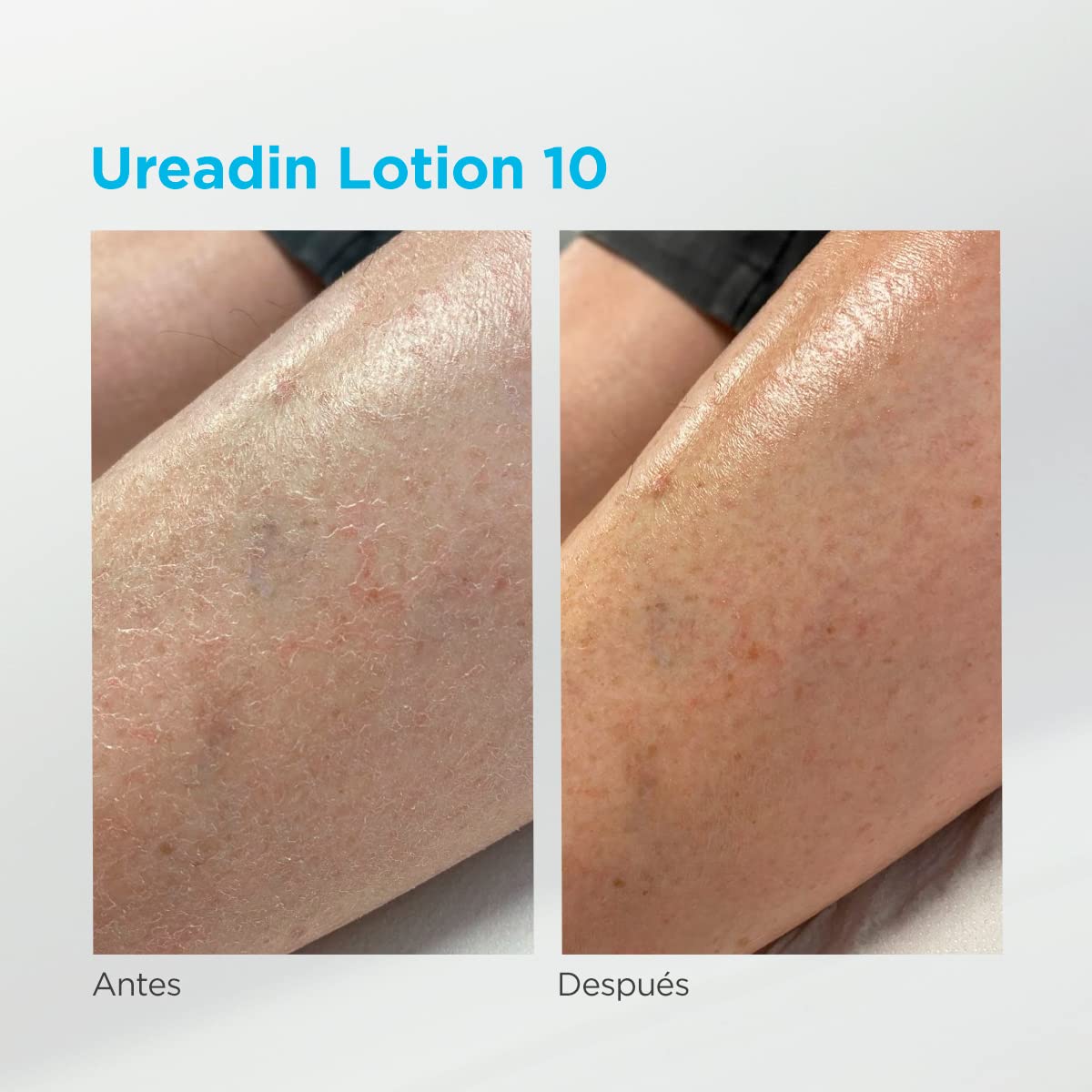 isdin-ureadin-lotion10-loci-n-hidratante-corporal-urea-10-pack-400ml-200ml image 6