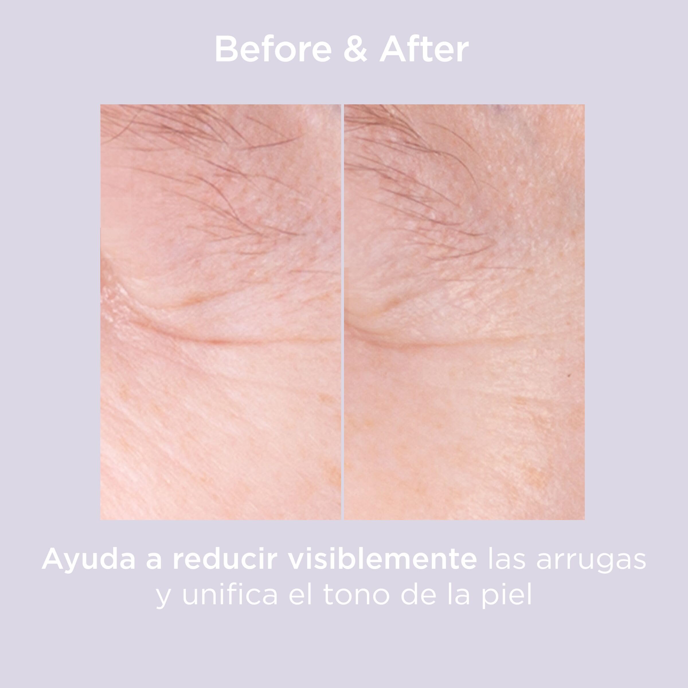 isdin-isdinceutics-glicoisdin-15-moderate-gel-facial-efecto-peeling-con-cido-gli image 8