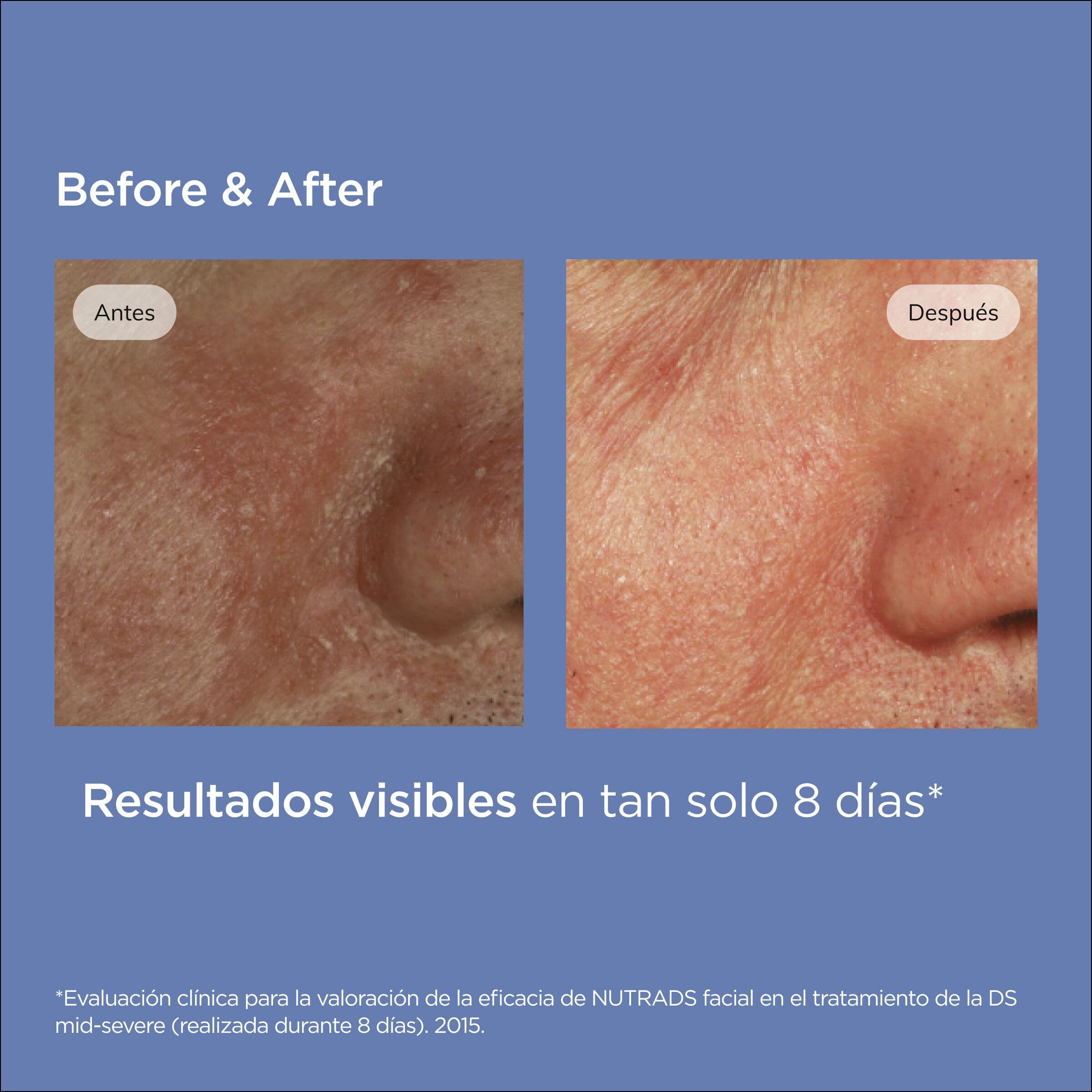 isdin-nutradeica-gel-crema-facial-para-piel-seborreica-50-ml image 8