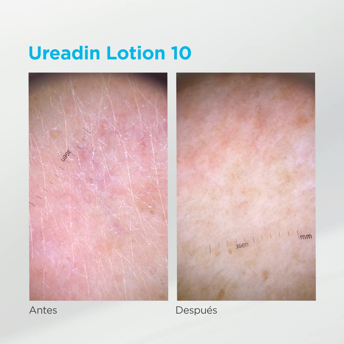 isdin-ureadin-lotion10-loci-n-hidratante-corporal-urea-10-pack-400ml-200ml image 7