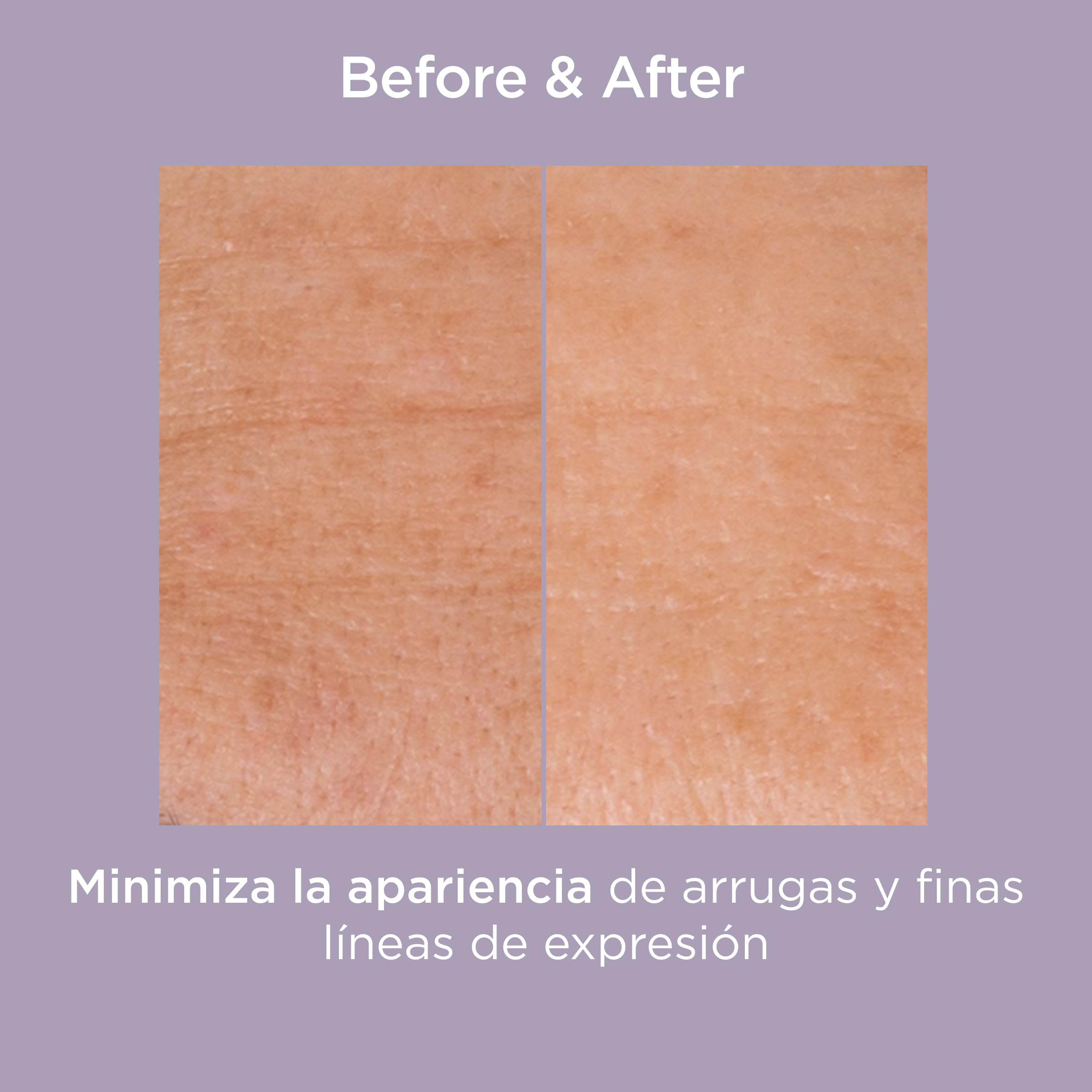 isdin-isdinceutics-glicoisdin-25-gel-exfoliante-facial-con-cido-glic-lico-25-g image 3