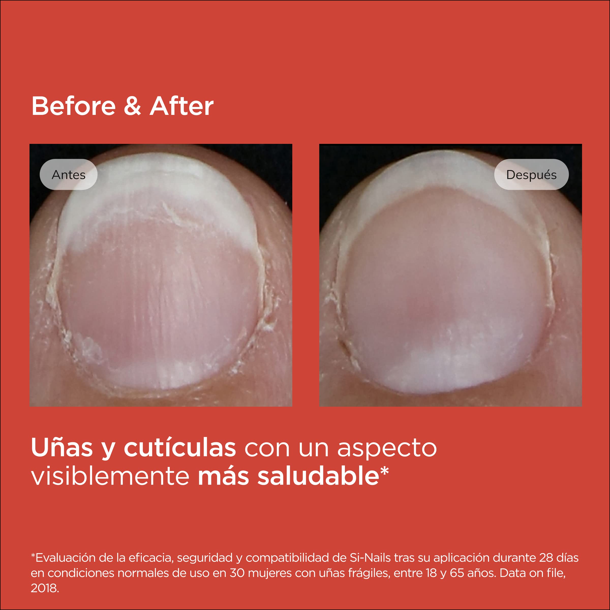 isdin-si-nails-fortalecedor-de-u-as-de-2-5-ml-con-resultados-visibles-en-14-d-as image 7