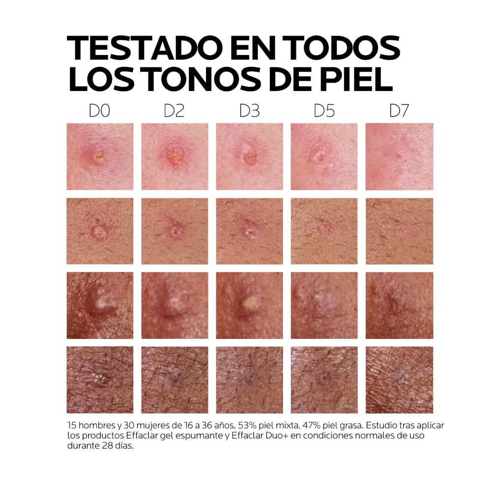 la-roche-posay-effaclar-duo-m-tratamiento-corrector-antiimperfecciones-40-ml image 5