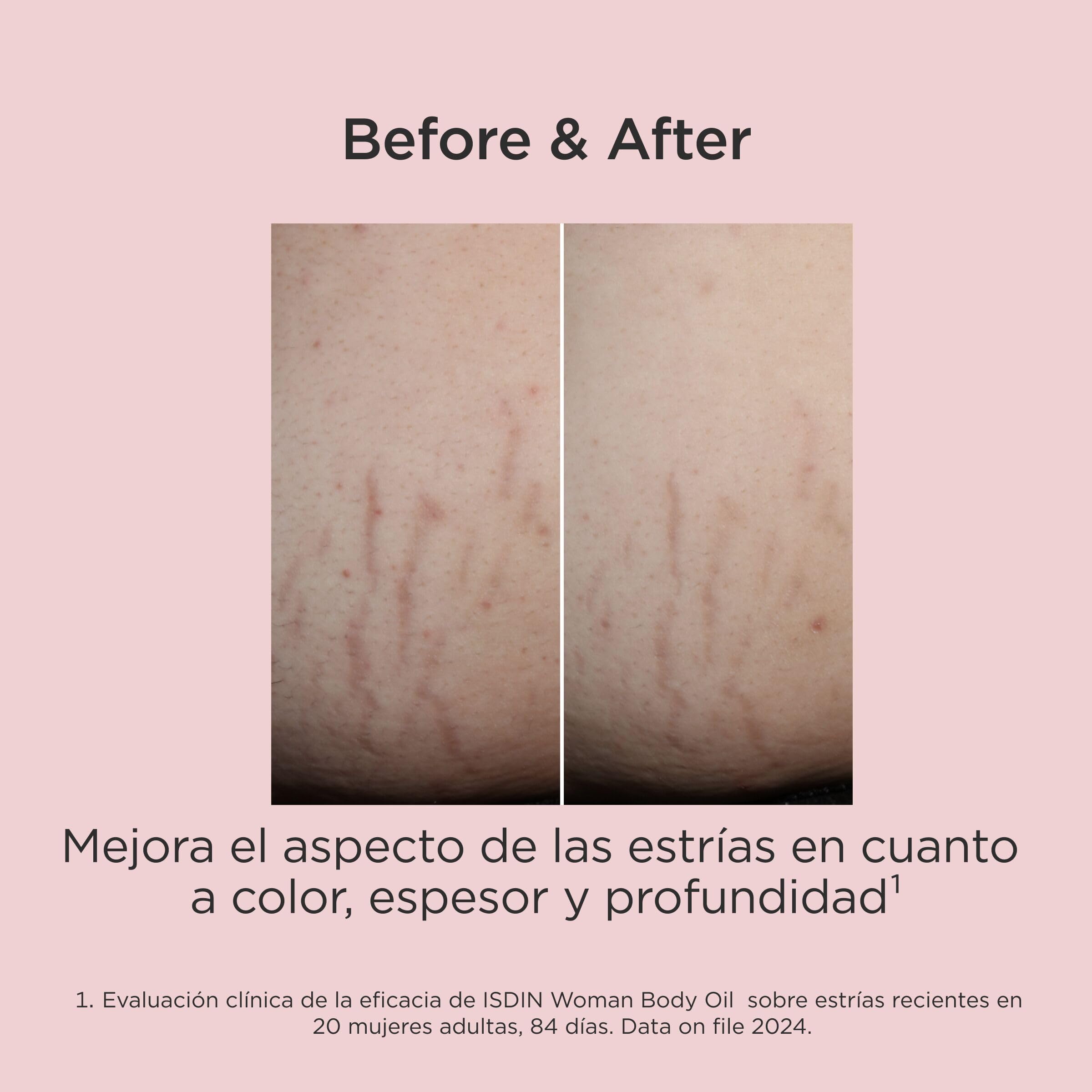 isdin-woman-body-oil-aceite-corporal-multibeneficio-para-estr-as-cicatrices-y-fi image 7